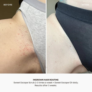 Bush Balm Ingrown Hair Oil | 1 fl oz / 30 mL